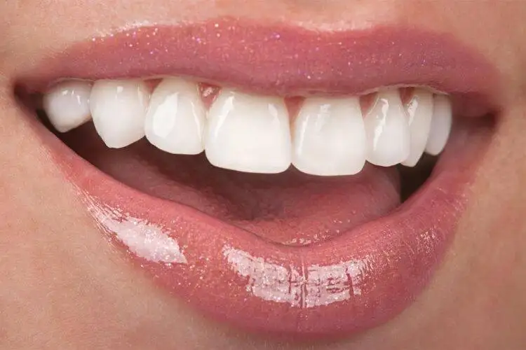 Healthy teeth